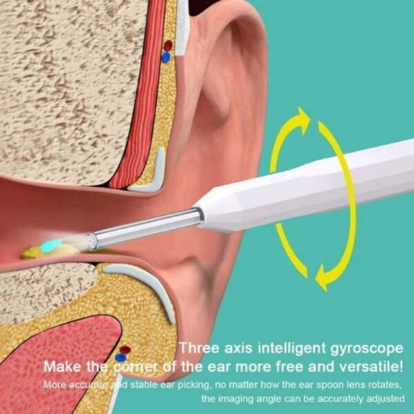 Wireless Visual Earpick - Image 2